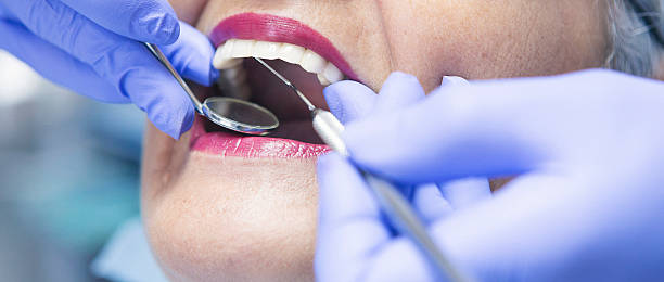 Best Emergency Dental Care for Broken or Chipped Teeth in Fallston, MD